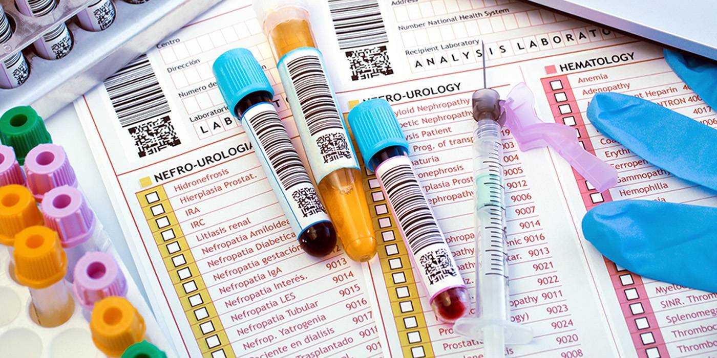 An assortment of viles and supplies used for collecting blood